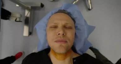 Spencer McNaughton prepares for a hair transplant in an operating room in Turkye Istanbul. Business Insider